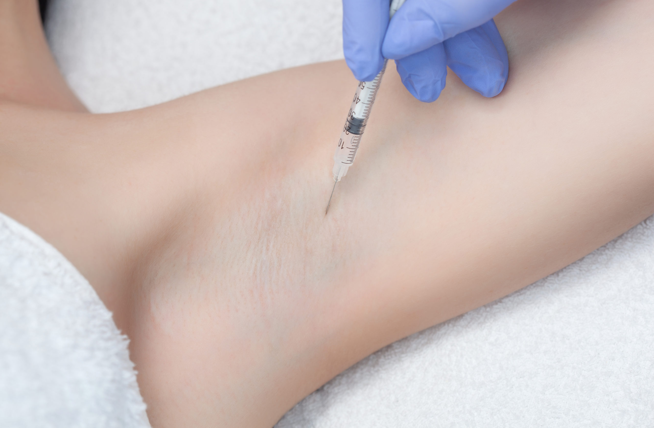 Botox injection therapy